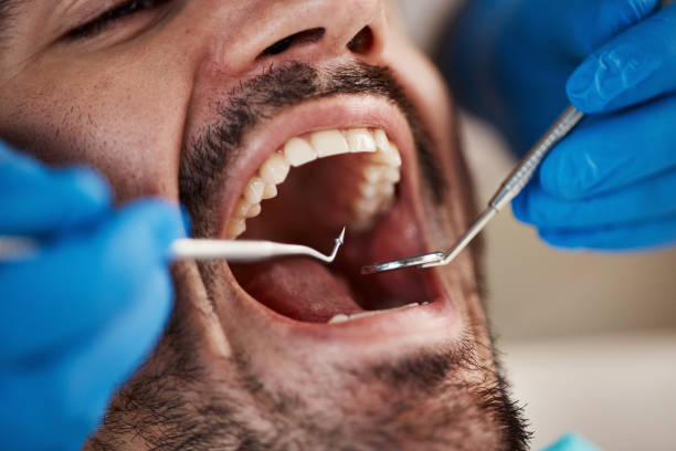 Best TMJ/TMD Treatment  in Lake Dunlap, TX